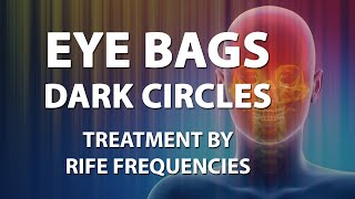 Eye Bags  Dark Circles  RIFE Frequencies Treatment  Energy amp Quantum Medicine with Bioresonance [upl. by Dryden]