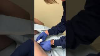 Mastectomy Drain removal [upl. by Fausta]