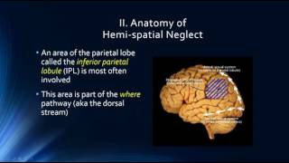 Neurophysiology of Attention Hemispatial Neglect [upl. by Dosh]