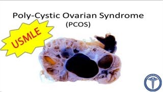 Polycystic Ovarian Syndrome PCOS  MADE EASY [upl. by Nitsid27]