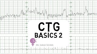 CTG Basics Part 2  Decelerations amp Fetal Physiology [upl. by Einna509]