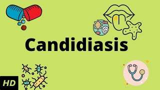 CANDIDIASIS Causes Signs and Symptoms Diagnosis and Treatment [upl. by Phoebe]