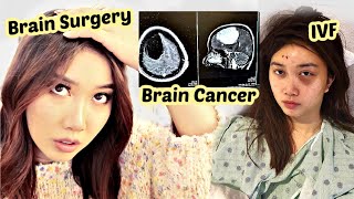 Life update Brain Surgery Brain Cancer and IVF Egg Freezing Journey [upl. by Labaw]