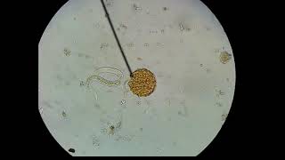 Ascaris lumbricoides hatching of egg [upl. by Anaher]