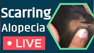 What is Scarring Alopecia Solution Of Scarring Alopecia6 [upl. by Galina]