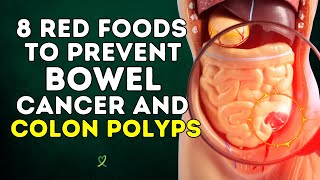 8 Red Foods To Prevent Bowel Cancer And Colon Polyps [upl. by Iey]