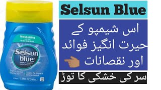 Selsun Blue Dandruff Shampoo Honest ReviewBest Dandruff Shampoo in PakistanDandruff Treatment [upl. by Carlye363]