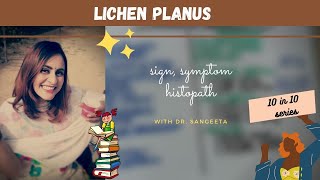 lichen planus I dental lectures [upl. by Macdonald]