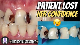 Amazing Restoration of the Patients Confidence C75 4K dental oralhealth dentalcare [upl. by Ayram]