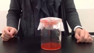 How do kidneys filter your blood [upl. by Puklich87]