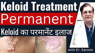 Keloid Removal Treatment  Keloid का इलाज  Dr Karoon Agrawal [upl. by Springer]