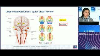 Acute ischaemic stroke New threapeutical strategies Park Soojin 2023 [upl. by Aicirtal]