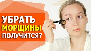 Омоложение лица как правильно использовать мезороллер Чего от него ждать Мезотерапия дома [upl. by Hime]