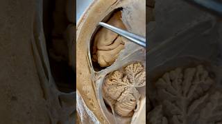 Incredible Tissue Surrounding Your Brain  Institute of Human Anatomy [upl. by Anaed]