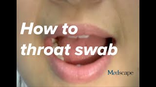 How to perform a throat swab on a patient [upl. by Gerbold269]