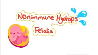 Nonimmune hydrops fetalis [upl. by Ardeth]