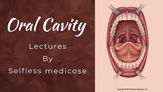 ORAL CAVITY LECTURE 7 Oral submucous fibrosis very important topic [upl. by Ludlew]