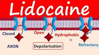 Lidocaine as Local Anesthetic [upl. by Ydok]