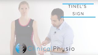 Tinels Test for Carpal Tunnel Syndrome  Clinical Physio [upl. by Hesoj]