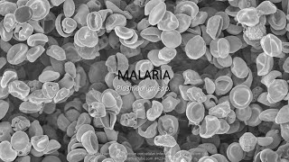 Malaria SINTOMATOLOGÍA notas de estudio [upl. by Ainomar33]