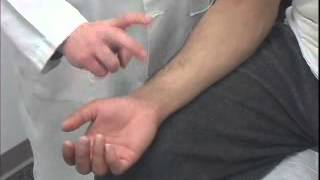 Tinels Test of the Carpal Tunnel [upl. by Ramoh411]