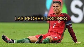 LAS PEORES LESIONES DE CRISTIANO RONALDO [upl. by Haleak263]