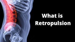 What is Retropulsion [upl. by Gerita]