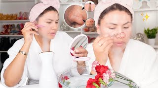 LIMPIEZA FACIAL PROFUNDA EN CASA PASO A PASO PIEL PERFECTA LIBRE DE IMPERFECCIONES♡ [upl. by Ynnek]