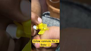 Yellow cannula fix in baby 👶  cannula cannulation trending shorts new SMpharmacy [upl. by Nnayar]