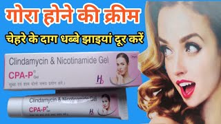 CPA P Gel  CPA P Gel Uses In Hindi  Clindamycin amp Nicotinamide Gel  गोरा होने की बेहतरीन क्रीम [upl. by Joye919]