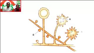 USMLE Step1 DAMS Histoplasmosis Integrated Approach [upl. by Drarej]