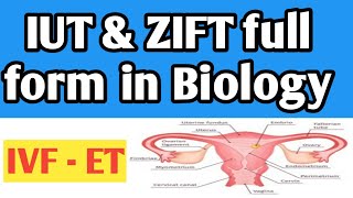 IUT amp ZIFT full form in biology in hindi  IVF  ET  IUT amp ZIFT का क्या फुल्लफॉर्म होता है [upl. by Aisatsana]