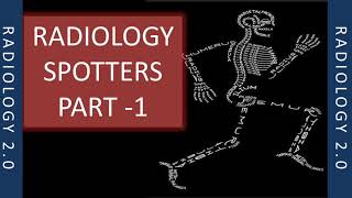 RADIOLOGY SPOTTERS RADIOLOGY 20 PART 1 XRAY [upl. by Pyotr]