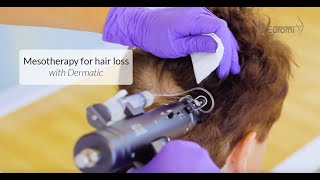 DERMATIC mesotherapy gun for hair loss [upl. by Denoting]