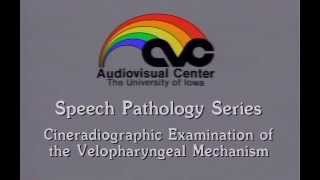 Cineradiographic Examination of the Velopharyngeal Mechanism [upl. by Bordiuk]