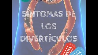 Síntomas de los Divertículos [upl. by Battista]