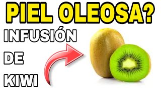 BENEFICIOS Y PROPIEDADES DE LA MASCARILLA DE KIWI PARA LA CARA PIEL GRASA  Deily Urquiola [upl. by Eniksre]