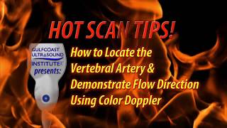 Hot TipHow to Locate the Vertebral Artery and Demonstrate Flow Direction [upl. by Nava]