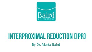 Interproximal Reduction IPR at Baird Orthodontics [upl. by Heinrick478]