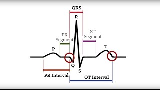 Tall Peaked T Waves  Cardiology for Medical Students [upl. by Oberg761]