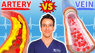 Why do we get plaque in Arteries but not in Veins  The Scientific Explanation [upl. by Marco987]