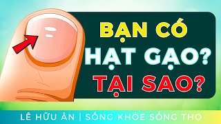 Bạn có những ĐỐM TRẮNG HẠT GẠO trên móng tay không Thiếu Chất Gì  đi cùng Giải Pháp Tự Nhiên [upl. by Maegan728]