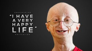 3 Simple Rules For A Happier Life  An Emotional Speech With Sam Berns [upl. by Alwin]