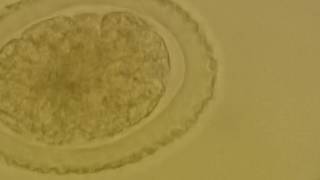 Fertilised corticated egg of Ascaris lumbricoides [upl. by Harilda]