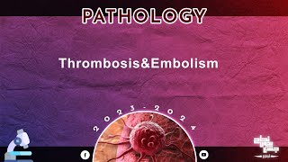 Revision of L 14 Thrombosis and embolism pathology [upl. by Letniuq]