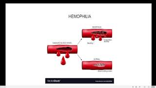 What is Hemophilia [upl. by Sil]