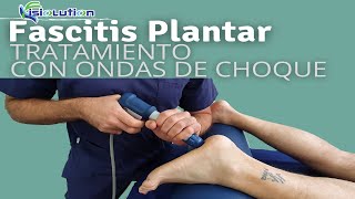 FASCITIS PLANTAR  TRATAMIENTO con ONDAS de CHOQUE DOLOR de PIE y TALON Fisioterapia  Fisiolution [upl. by Sibyl945]