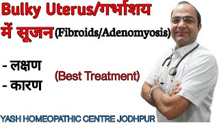 Bulky Uterus  Enlarged Uterus  Fibroid Adenomyosis  Treatment without surgery [upl. by Karlin]