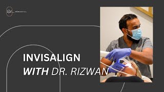 Benefits of Invisalign With Dr Rizwan [upl. by Enetsirhc]