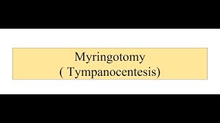 MYRINGOTOMY [upl. by Free]